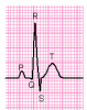 A-level Biology-Transport-mammalian heart - Wikibooks, open books for an open world.png