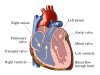 aortic-valve-disease-1.jpg